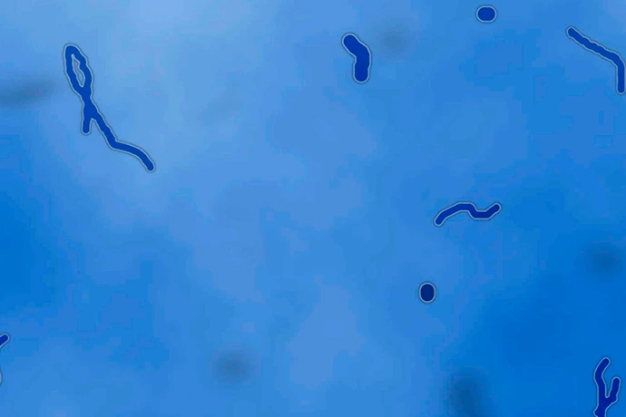 Visão simulada em tons de azul, exibindo várias formas escuras e irregulares, além de objetos flutuantes, no campo visual